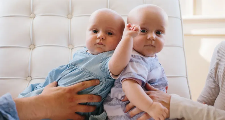 Monochorionic twins