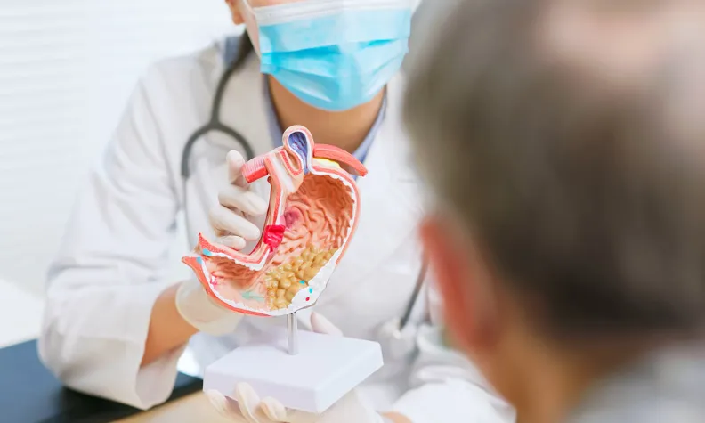 Un professionnel de santé portant un masque et des gants tient et montre un modèle anatomique détaillé de l’œsophage et de l’estomac, l’expliquant à un patient assis lors d’une consultation médicale.
