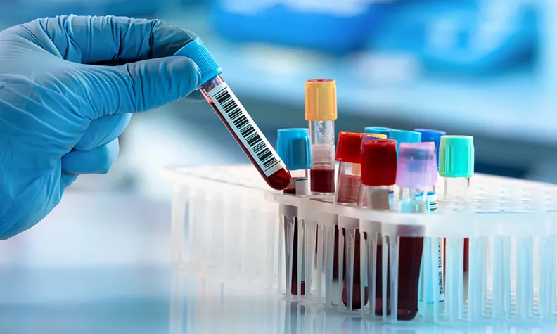 A gloved hand holds a blood sample vial with a barcode label, next to several other vials with coloured caps in a plastic rack on a laboratory table.