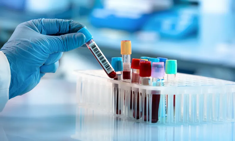 A gloved hand holds a blood sample vial above a rack containing multiple vials with different colored caps in a laboratory setting.