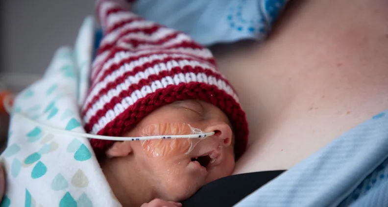 A premature baby wearing a red and white striped knit hat rests against a person’s chest. The baby has a feeding tube secured to their face with tape and is wrapped in a blue blanket with heart patterns.