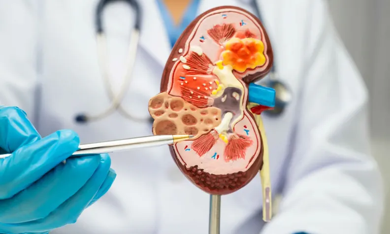 A doctor wearing blue gloves and a white coat holds a model of a human kidney with forceps, demonstrating its internal structure. A stethoscope hangs around the doctors neck.