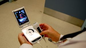 “Doc, how is my heart doing?”