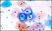 Cytopathology