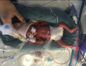 avalina.NICU1 448