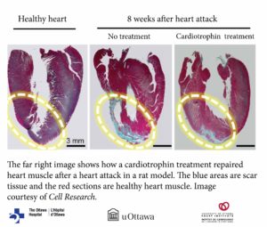 image of cardiotrophin treatment using a heart of a rat