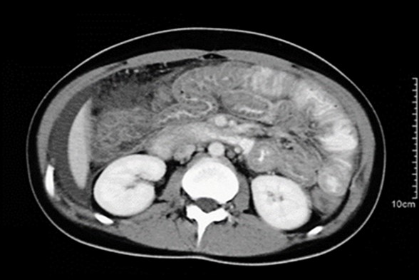 Computed Tomography (CT) | The Ottawa Hospital