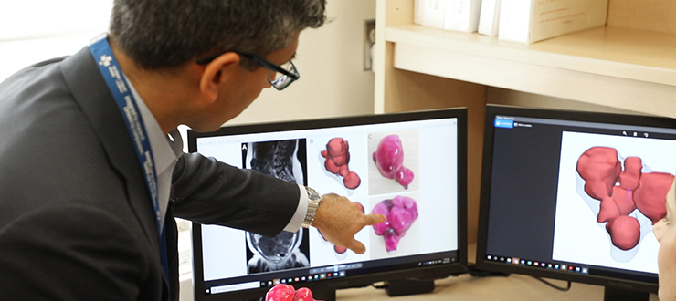 Dr. Singh is pointing the tumour on the 3D print screen