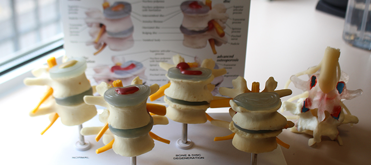 Models of the spine