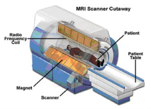 The MRI machine, which includes the patient, patient table, radio frequency coil, magnet, and scanne