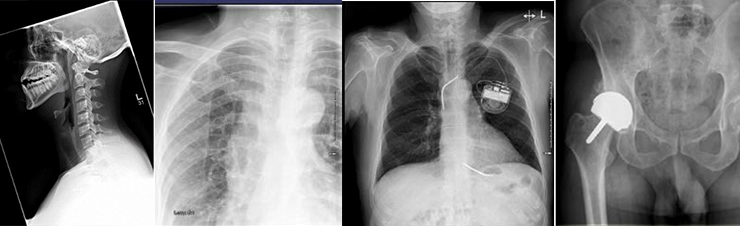 x-ray of a patients