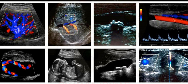 Image containing multiple ultrasound pictures