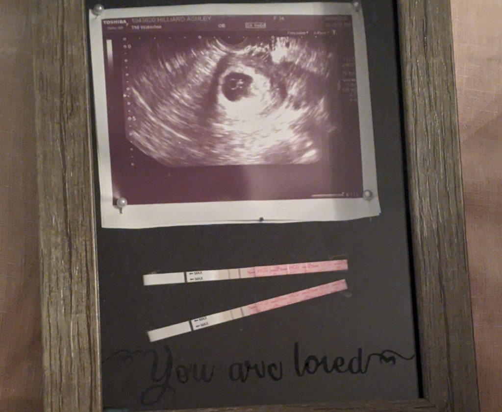 Ultrasound of Ashley Hilliard’s fetus