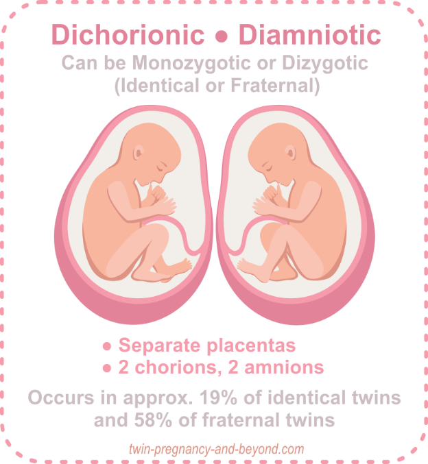 Dizygotes-Diamniotiques