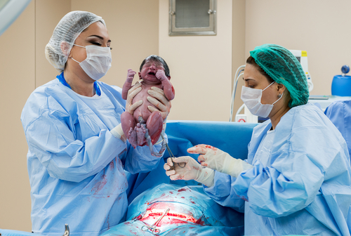Surgical team performing surgery operation. Doctor performing surgery using sterilized equipment. Gynecologists and midwifes giving birth. Infant in maternity hospital