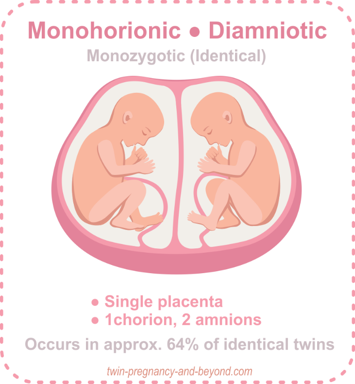 Monozygotes-Diamniotiques
