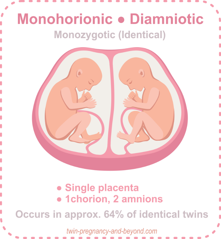 Mono-Di Twins