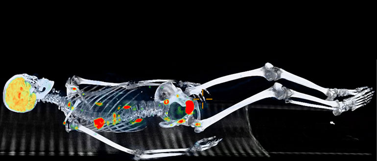 Imaging of a human skeleton